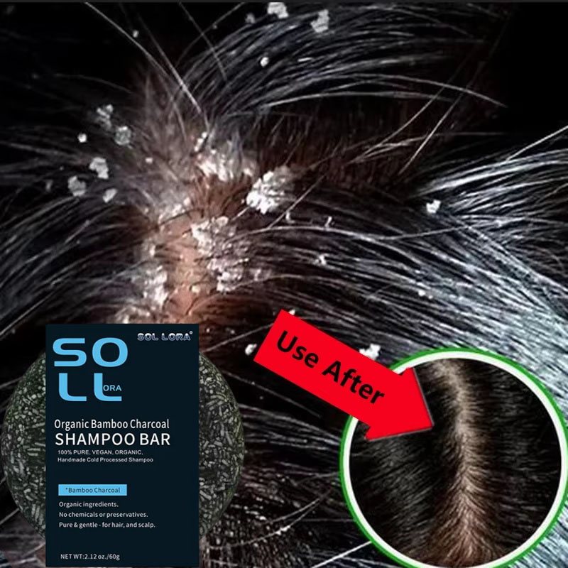 Fast Anti Dandruff Hair Treatm - Hair Care Dandruff recension och pris