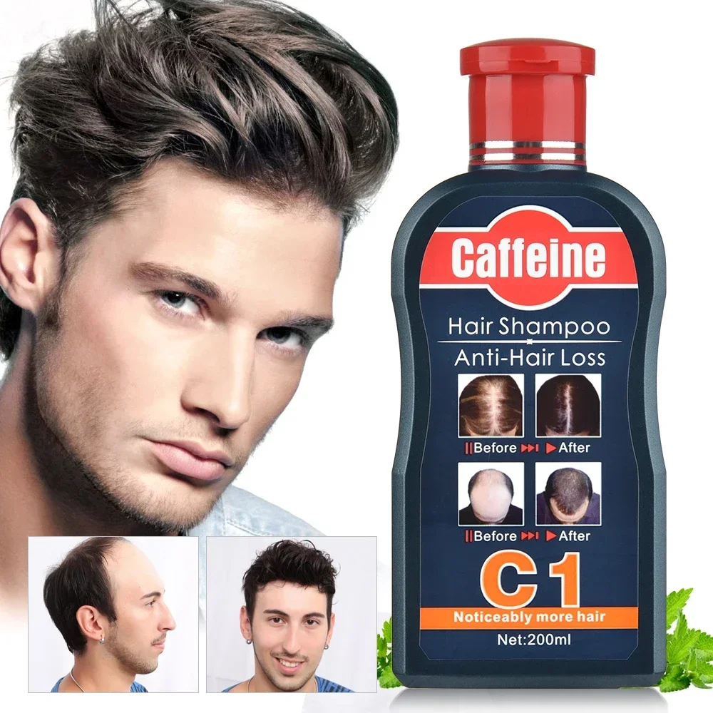 Men Shampoo For Hair Growth Na - Hair Care Korean Products recension och pris